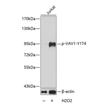 Western Blot - Anti-VAV1 (phospho Tyr174) Antibody (A16496) - Antibodies.com