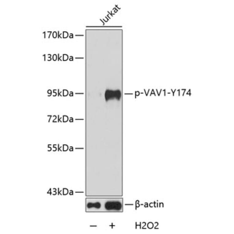 Western Blot - Anti-VAV1 (phospho Tyr174) Antibody (A16496) - Antibodies.com