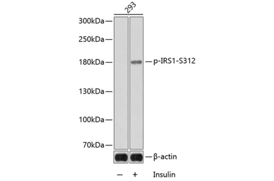 Western Blot - Anti-IRS1 (phospho Ser312) Antibody (A16497) - Antibodies.com