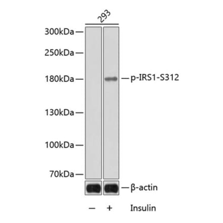 Western Blot - Anti-IRS1 (phospho Ser312) Antibody (A16497) - Antibodies.com