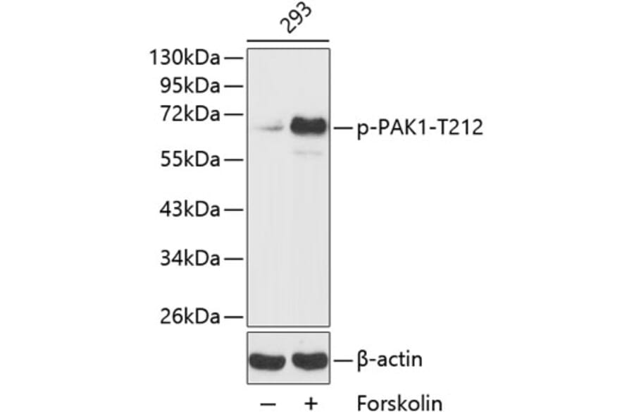 Western Blot - Anti-PAK1 (phospho T212) Antibody (AP0186) - Antibodies.com