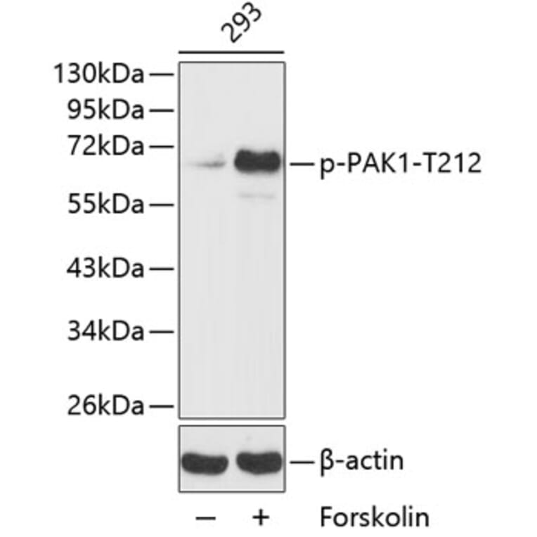 Western Blot - Anti-PAK1 (phospho T212) Antibody (AP0186) - Antibodies.com