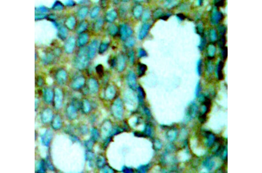 Immunohistochemistry - Anti-PAK1 (phospho T212) Antibody (AP0186) - Antibodies.com