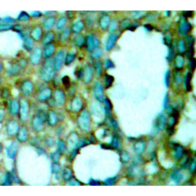 Immunohistochemistry - Anti-PAK1 (phospho T212) Antibody (AP0186) - Antibodies.com