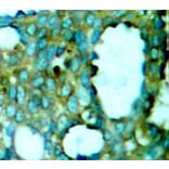Immunohistochemistry - Anti-PAK1 (phospho T212) Antibody (AP0186) - Antibodies.com