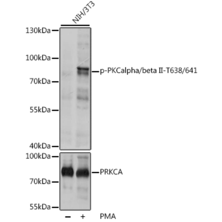 Western Blot - Anti-PKC alpha +PKC beta (phospho Thr638 + Thr641) Antibody (A16501) - Antibodies.com