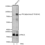 Western Blot - Anti-PKC alpha +PKC beta (phospho Thr638 + Thr641) Antibody (A16501) - Antibodies.com