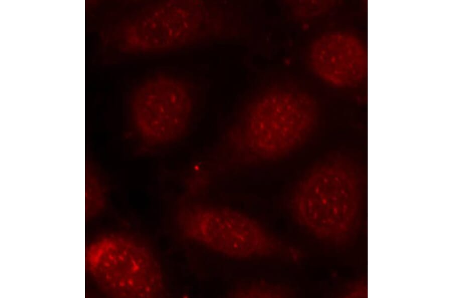 Immunofluorescence - Anti-PKC alpha +PKC beta (phospho Thr638 + Thr641) Antibody (A16501) - Antibodies.com