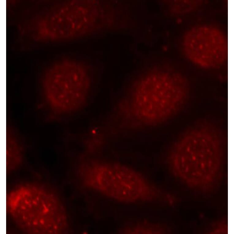Immunofluorescence - Anti-PKC alpha +PKC beta (phospho Thr638 + Thr641) Antibody (A16501) - Antibodies.com