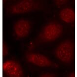 Immunofluorescence - Anti-PKC alpha +PKC beta (phospho Thr638 + Thr641) Antibody (A16501) - Antibodies.com