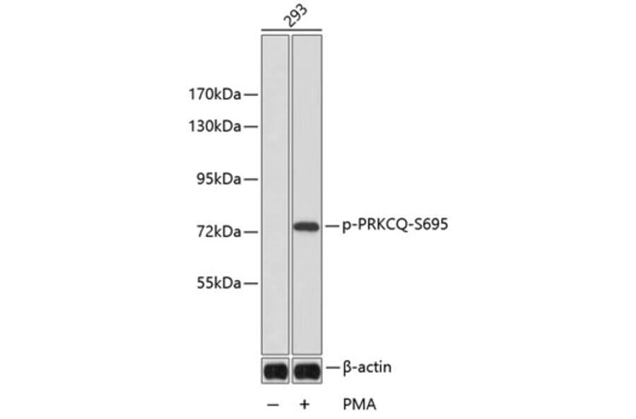 Western Blot - Anti-PRKCQ (phospho S695) Antibody (AP0192) - Antibodies.com