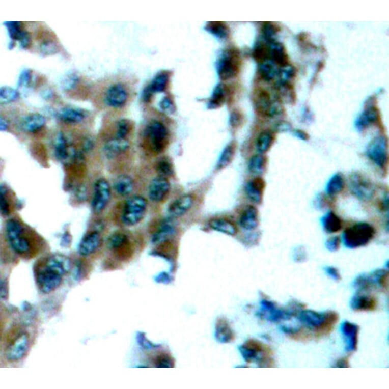 Immunohistochemistry - Anti-PRKCQ (phospho S695) Antibody (AP0192) - Antibodies.com