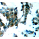 Immunohistochemistry - Anti-PRKCQ (phospho S695) Antibody (AP0192) - Antibodies.com