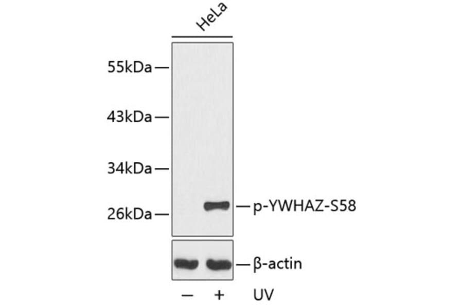 Western Blot - Anti-14-3-3 zeta (phospho Ser58) Antibody (A16504) - Antibodies.com