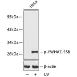 Western Blot - Anti-14-3-3 zeta (phospho Ser58) Antibody (A16504) - Antibodies.com