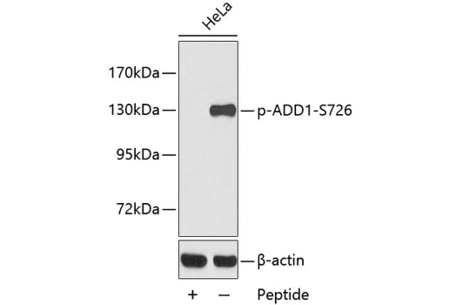 Western Blot - Anti-ADD1 (phospho S726) Antibody (AP0196) - Antibodies.com