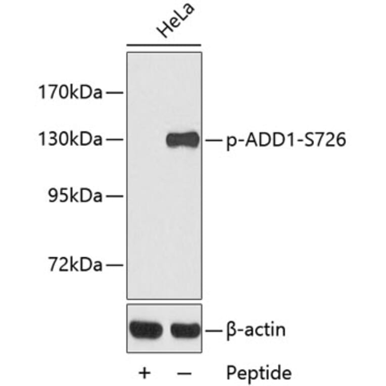 Western Blot - Anti-ADD1 (phospho S726) Antibody (AP0196) - Antibodies.com
