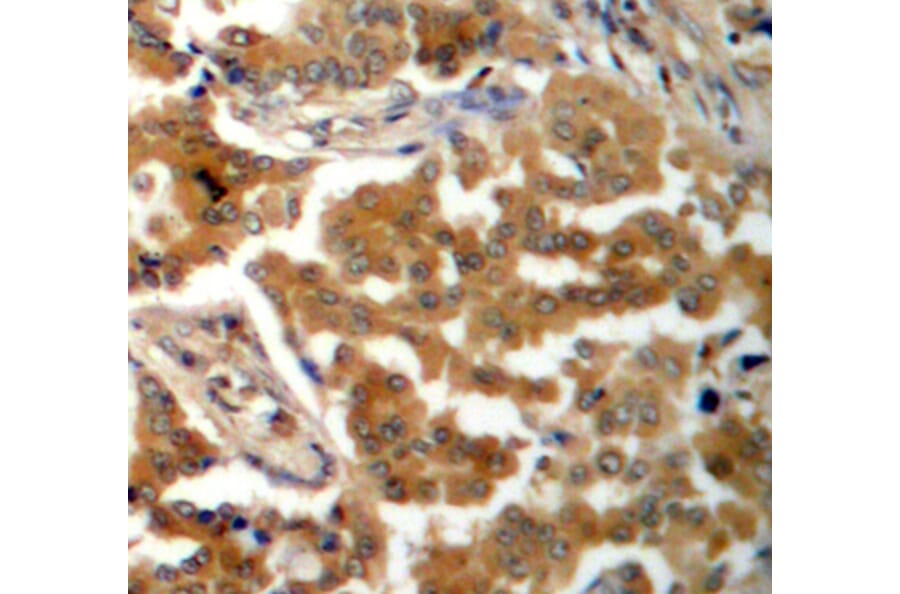 Immunohistochemistry - Anti-ADD1 (phospho S726) Antibody (AP0196) - Antibodies.com