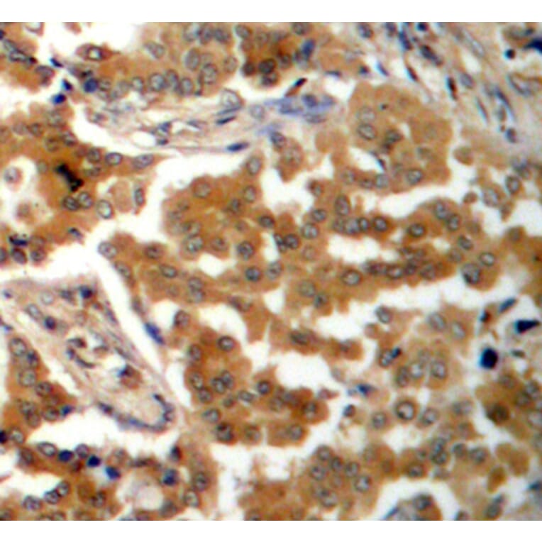 Immunohistochemistry - Anti-ADD1 (phospho S726) Antibody (AP0196) - Antibodies.com