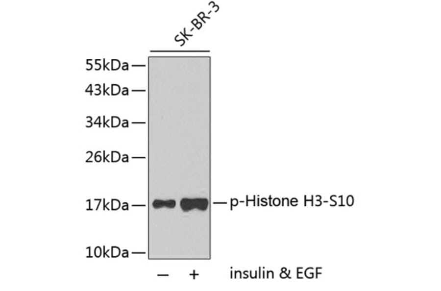 Western Blot - Anti-Histone H3 (phospho S10) Antibody (AP0197) - Antibodies.com