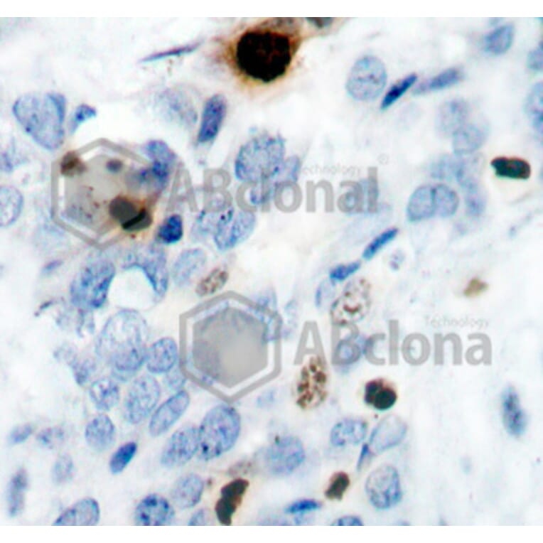 Immunohistochemistry - Anti-Histone H3 (phospho S10) Antibody (AP0197) - Antibodies.com