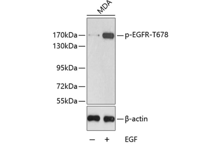 Western Blot - Anti-EGFR (phospho T678) Antibody (AP0198) - Antibodies.com