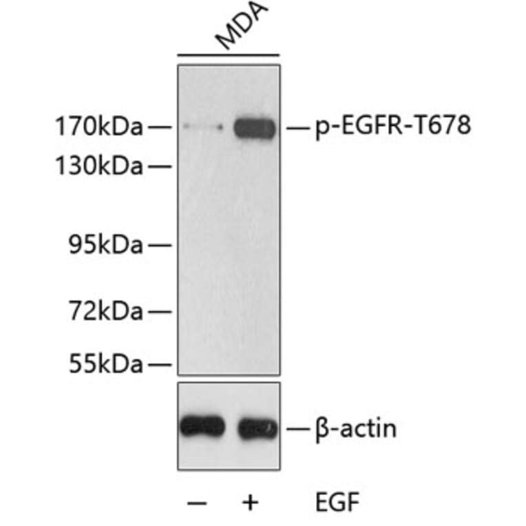 Western Blot - Anti-EGFR (phospho T678) Antibody (AP0198) - Antibodies.com