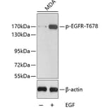 Western Blot - Anti-EGFR (phospho T678) Antibody (AP0198) - Antibodies.com