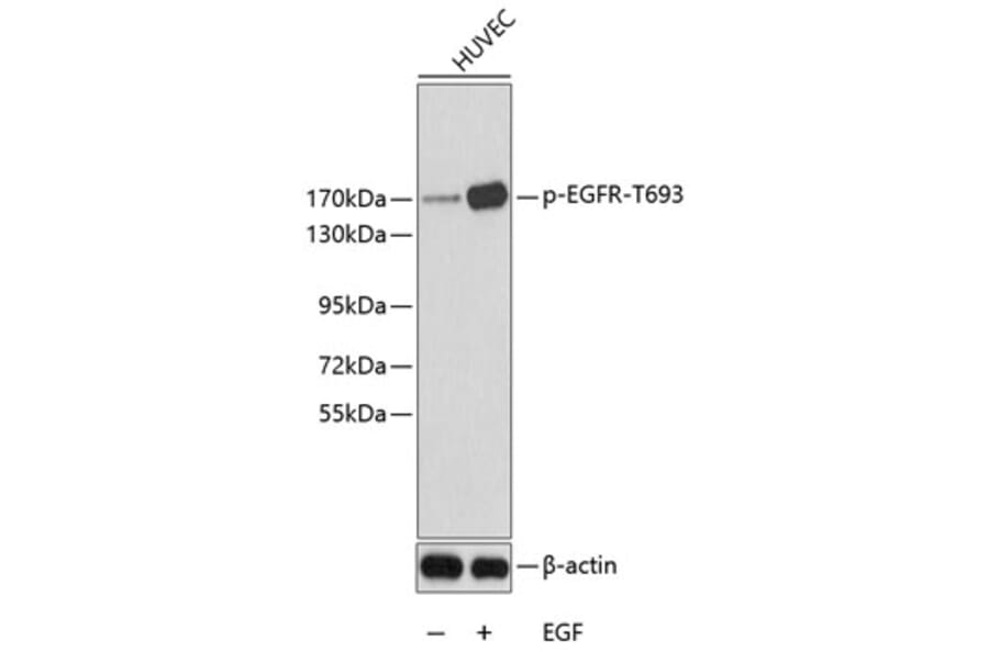 Western Blot - Anti-EGFR (phospho T693) Antibody (AP0199) - Antibodies.com