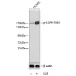 Western Blot - Anti-EGFR (phospho T693) Antibody (AP0199) - Antibodies.com