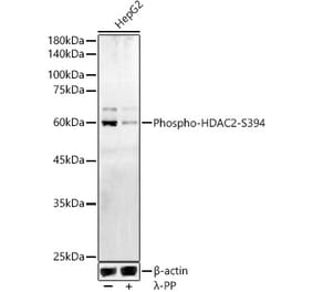 Western Blot - Anti-HDAC2 (phospho Ser394) Antibody (A16510) - Antibodies.com