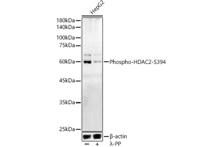 Western Blot - Anti-HDAC2 (phospho Ser394) Antibody (A16510) - Antibodies.com