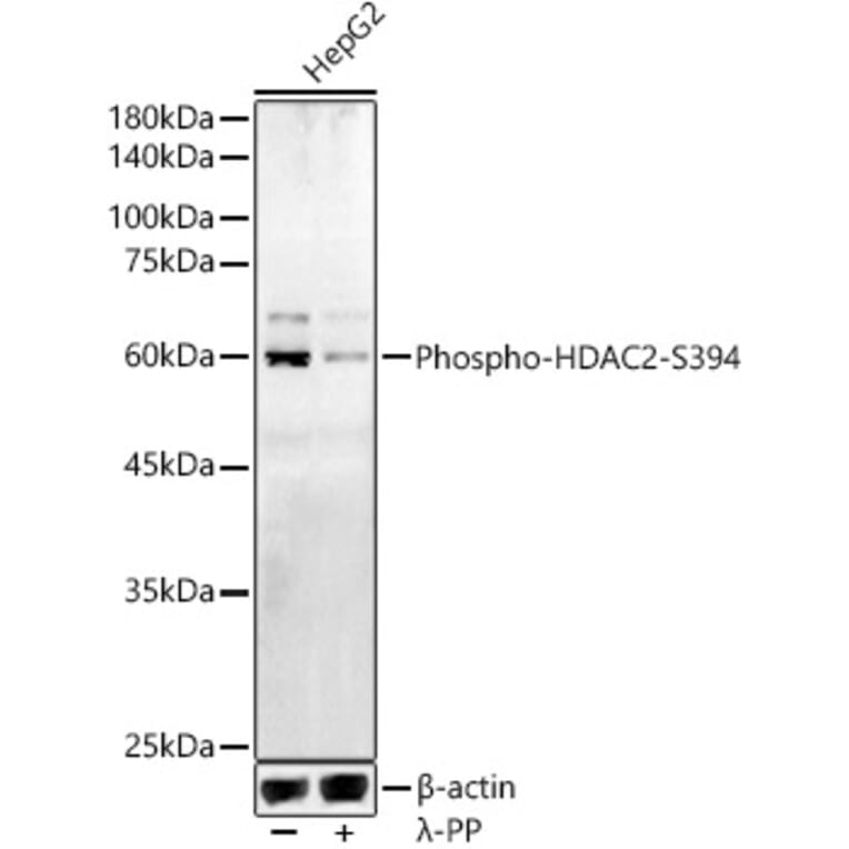 Western Blot - Anti-HDAC2 (phospho Ser394) Antibody (A16510) - Antibodies.com