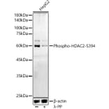 Western Blot - Anti-HDAC2 (phospho Ser394) Antibody (A16510) - Antibodies.com