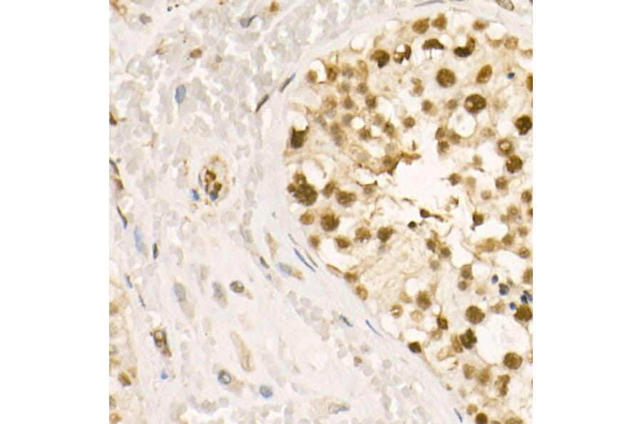 Immunohistochemistry - Anti-HDAC2 (phospho Ser394) Antibody (A16510) - Antibodies.com