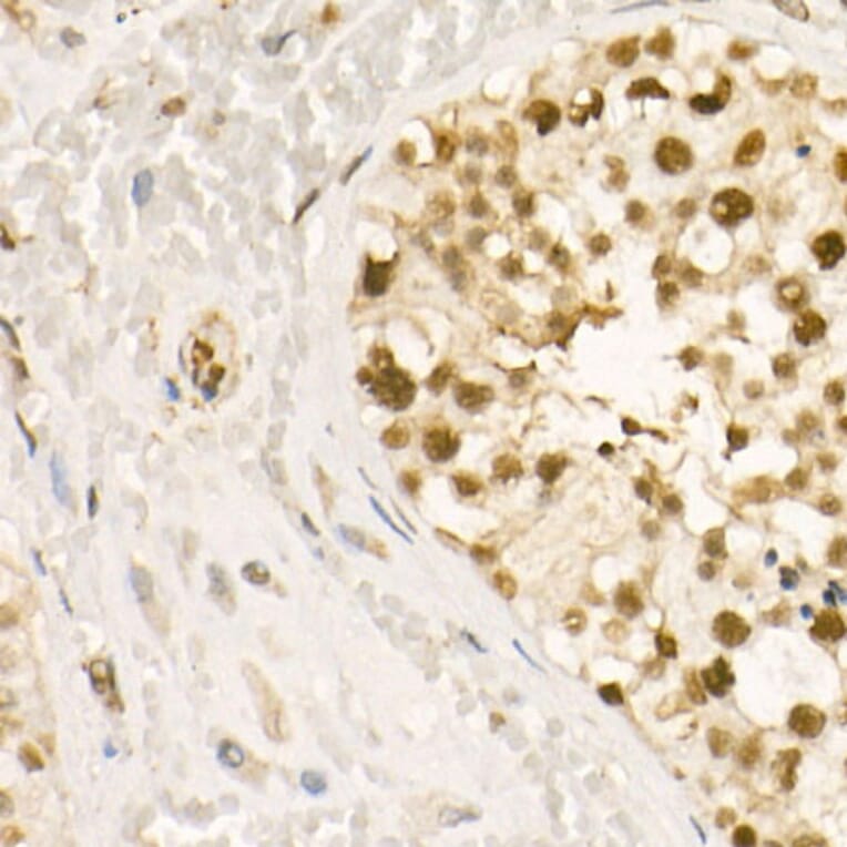 Immunohistochemistry - Anti-HDAC2 (phospho Ser394) Antibody (A16510) - Antibodies.com