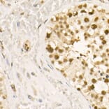 Immunohistochemistry - Anti-HDAC2 (phospho Ser394) Antibody (A16510) - Antibodies.com