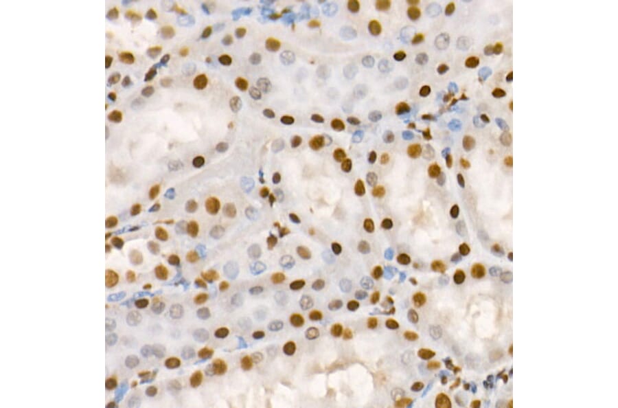 Immunohistochemistry - Anti-HDAC2 (phospho Ser394) Antibody (A16510) - Antibodies.com