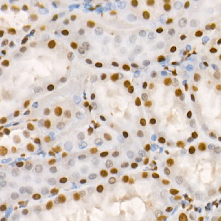 Immunohistochemistry - Anti-HDAC2 (phospho Ser394) Antibody (A16510) - Antibodies.com