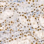 Immunohistochemistry - Anti-HDAC2 (phospho Ser394) Antibody (A16510) - Antibodies.com