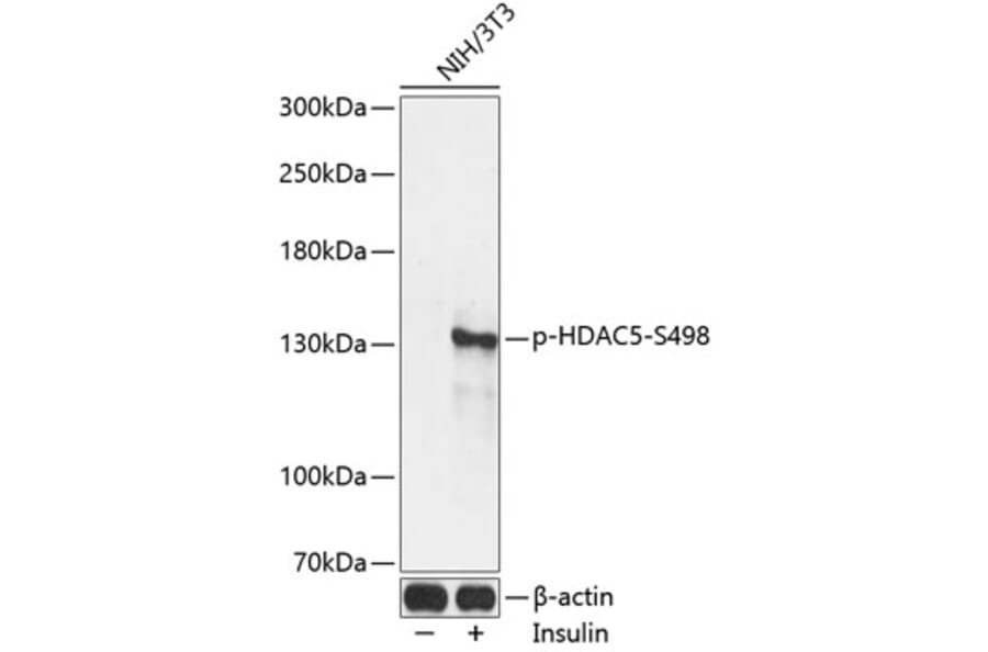 Western Blot - Anti-HDAC5 (phospho Ser498) Antibody (A16511) - Antibodies.com