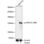 Western Blot - Anti-HDAC5 (phospho Ser498) Antibody (A16511) - Antibodies.com