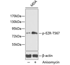 Western Blot - Anti-Ezrin (phospho Thr567) Antibody (A16514) - Antibodies.com