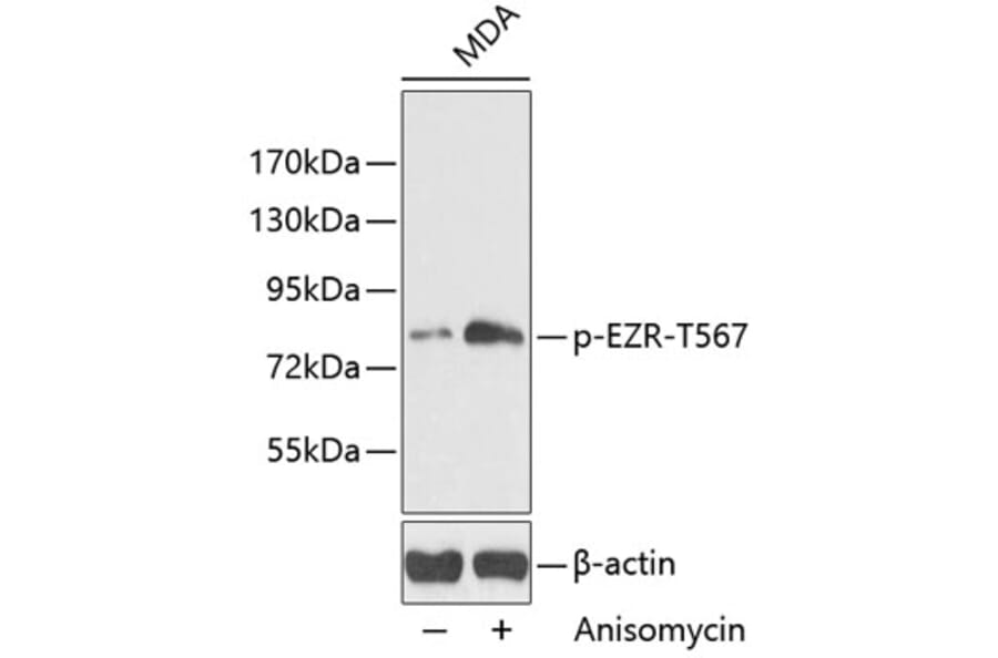 Western Blot - Anti-Ezrin (phospho Thr567) Antibody (A16514) - Antibodies.com