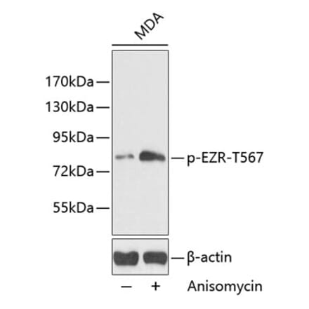 Western Blot - Anti-Ezrin (phospho Thr567) Antibody (A16514) - Antibodies.com