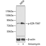 Western Blot - Anti-Ezrin (phospho Thr567) Antibody (A16514) - Antibodies.com