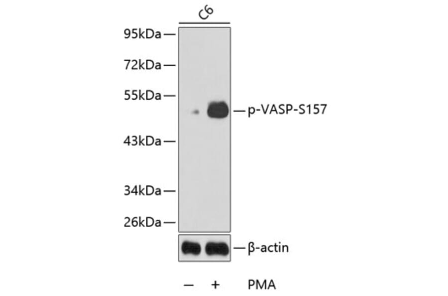 Western Blot - Anti-VASP (phospho S157) Antibody (AP0213) - Antibodies.com