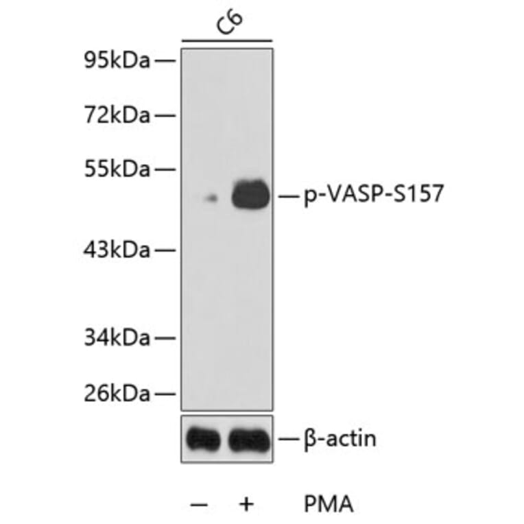Western Blot - Anti-VASP (phospho S157) Antibody (AP0213) - Antibodies.com