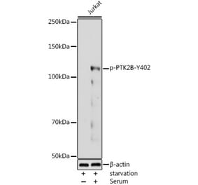 Western Blot - Anti-PYK2 (phospho Tyr402) Antibody (A16518) - Antibodies.com