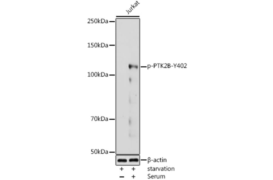 Western Blot - Anti-PYK2 (phospho Tyr402) Antibody (A16518) - Antibodies.com